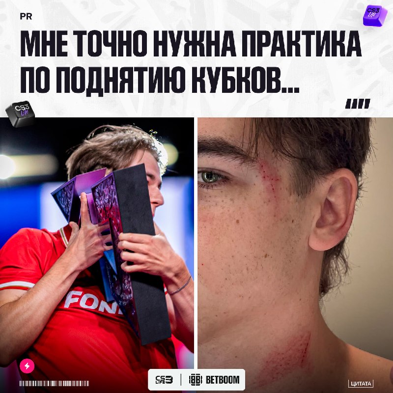 У вчерашней победы MOUZ есть последствия — PR неудачно поднял чемпионский кубок и получил травму.